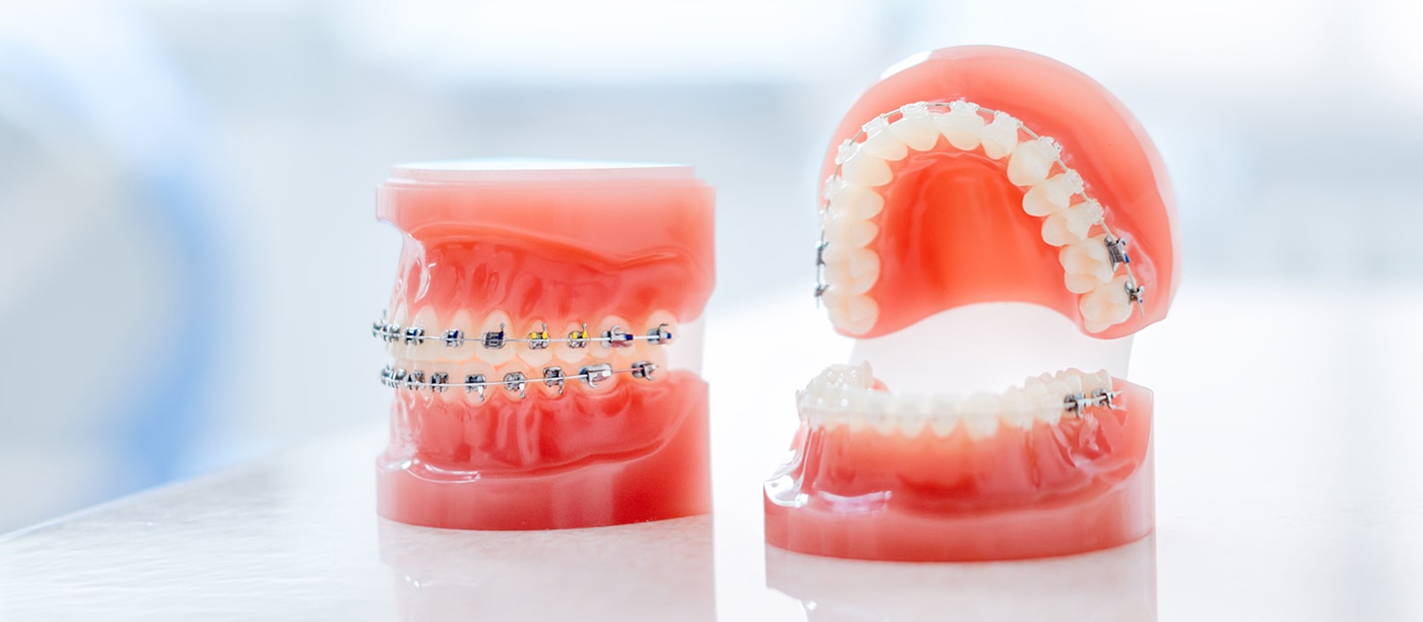 当院の矯正歯科の特徴